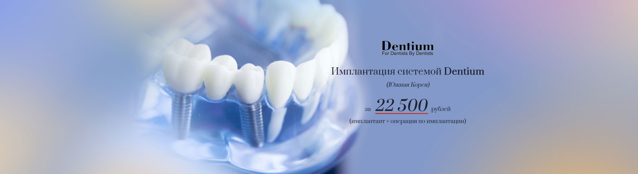 Dentium импланты отзывы. Имплантация Dentium. Корейские импланты Дентиум. Формирователь Дентиум. Зубной Химки Куркино.