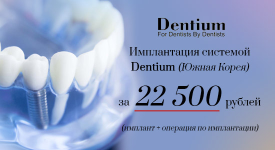 Имплантация системой Dentium за 22 500 рублей